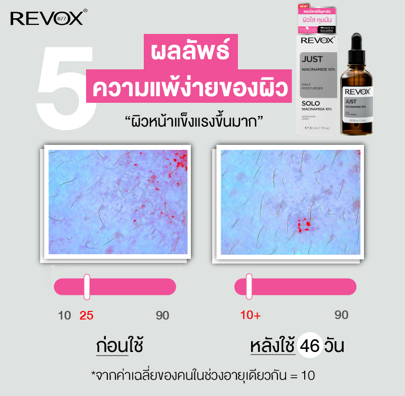 Revox B77 - Skin Test