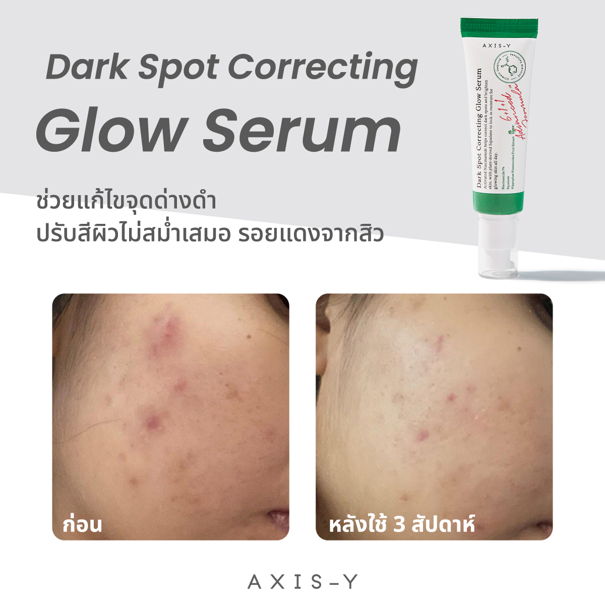 AXIS-Y Dark Spot Correcting Glow Serum